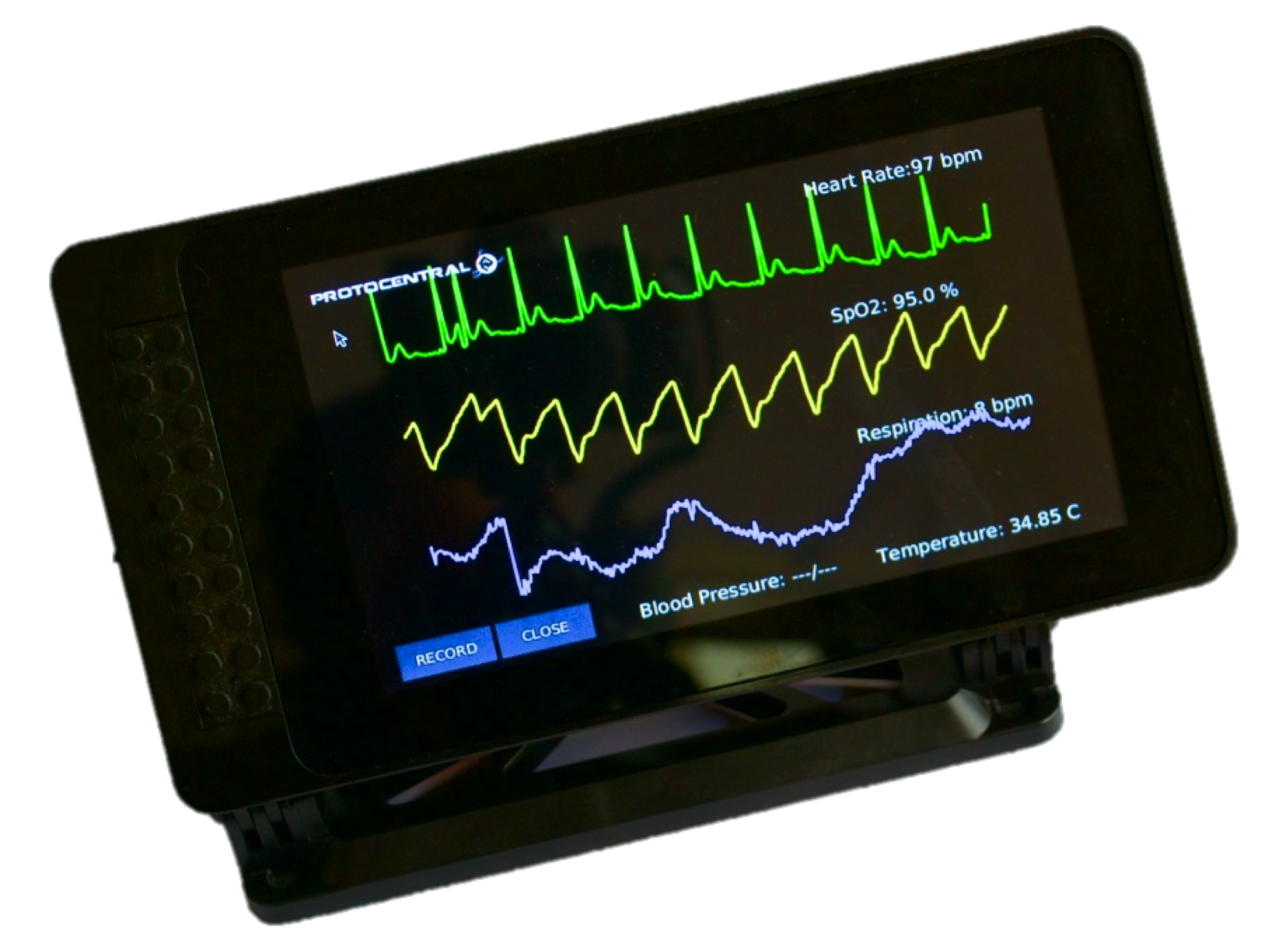 Nextgen Remote Patient Monitoring